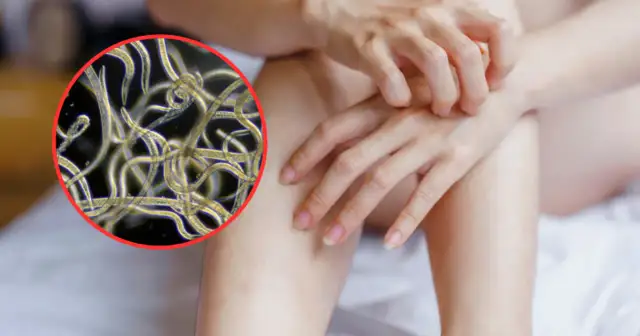 Objawy odrobaczania – czego się spodziewać po leczeniu pasożytów?