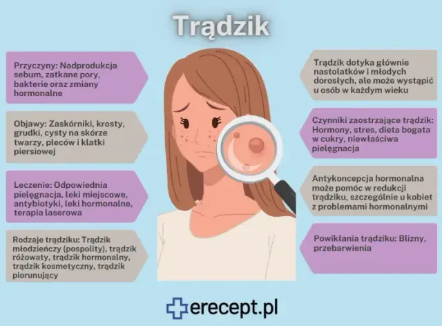 Pryszcze na czole: Przyczyny, znaczenie i skuteczne sposoby leczenia