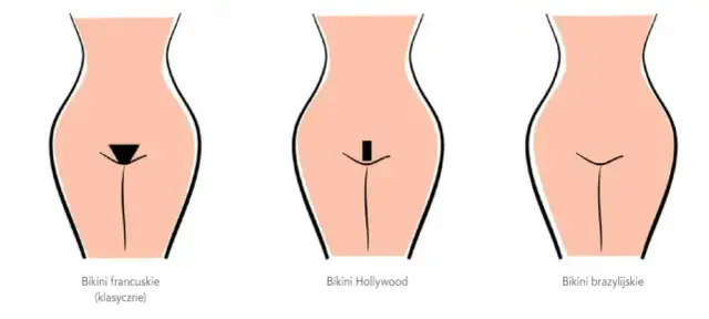 Depilacja laserowa bikini: Ile trwa? Pełny harmonogram i efekty