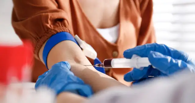 Czy ferrytyna jest na NFZ? Sprawdź, co musisz wiedzieć o badaniu