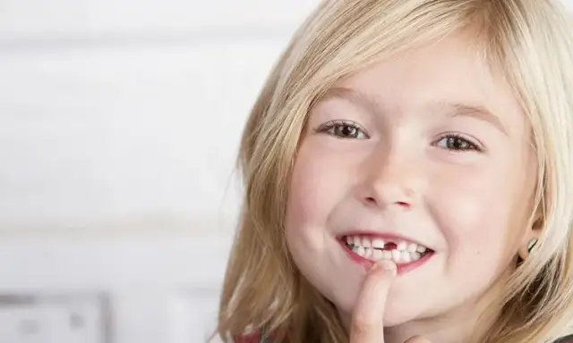 Jak wyrwać zęba mlecznego bez bólu i stresu dla dziecka