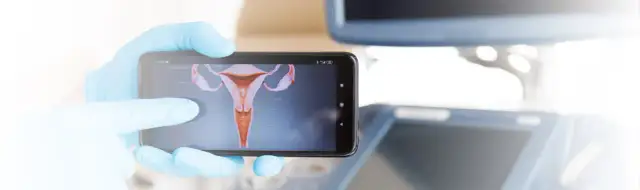 Gdzie sprawdzić wynik cytologii NFZ i uniknąć niepotrzebnych opóźnień