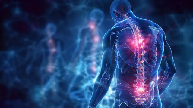 Skuteczne leki na rwę kulszową: lista, działanie i dawkowanie