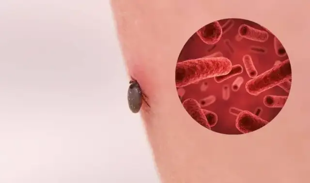 Skuteczne sposoby na pozbycie się kleszczy z działki i ochronę zdrowia