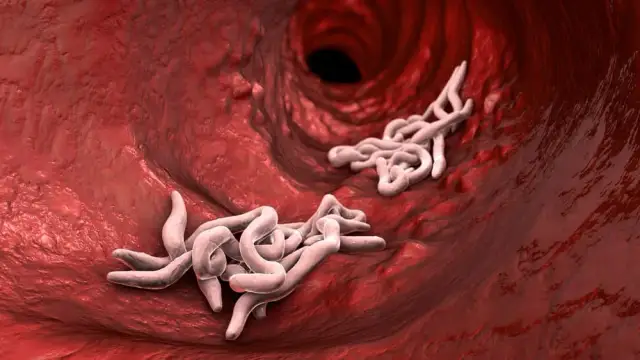 Jak sprawdzić czy dziecko ma owsiki? Objawy, diagnoza i leczenie