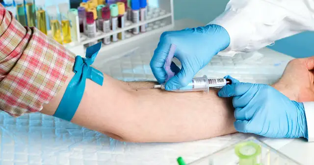 Podwyższone RDW-SD - O czym świadczy ten wynik i co warto zbadać?