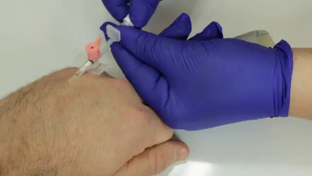 Jak podłączyć kroplówkę - instrukcja bezpiecznego podłączenia