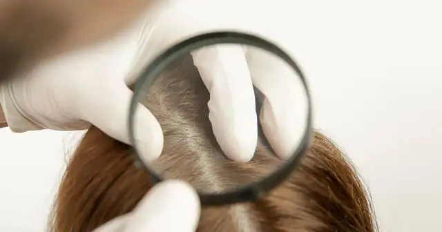 Wie viele Haare hat der Mensch? Die überraschende Antwort