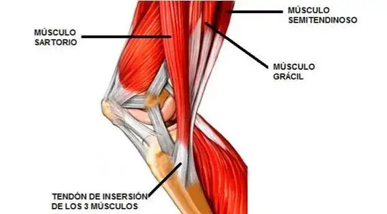 Dolor en el músculo sartorio: causas, síntomas y soluciones efectivas