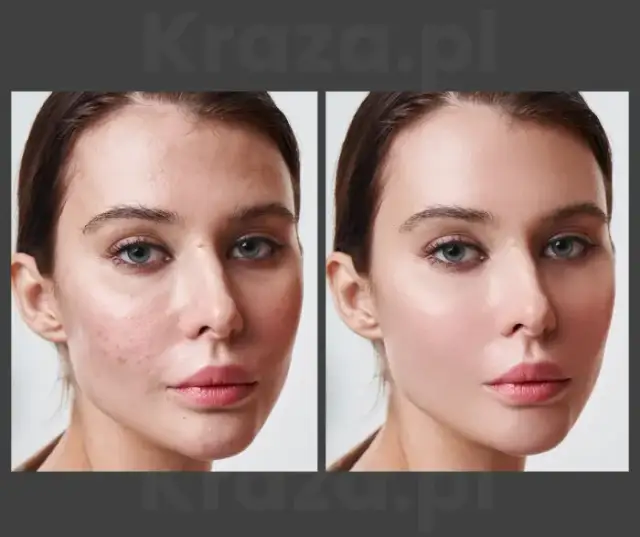 Obróbka zdjęć w Photoshopie: Krok po kroku. Opanuj AI i retusz!