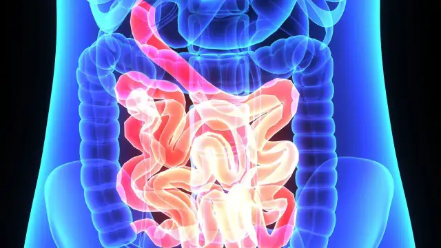 Leniwe jelita? Pobudź perystaltykę: dieta, ruch i zioła!