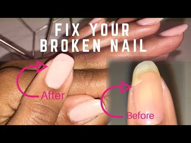 Czy pęknięty paznokieć się zrośnie? Poznaj prawdę o leczeniu