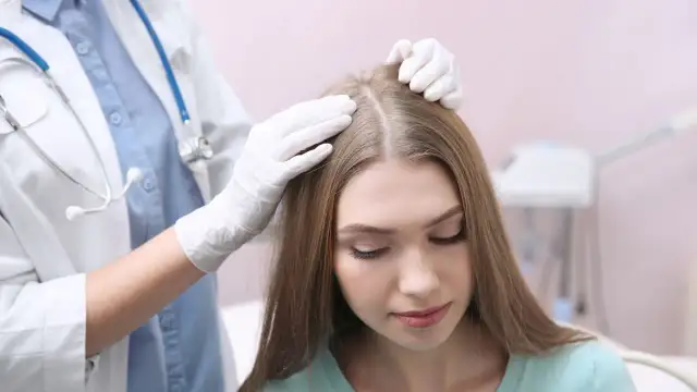 Lekarz od włosów bada skórę głowy pacjentki.