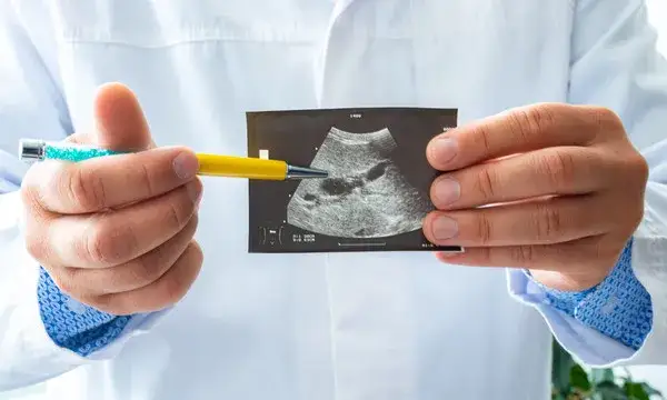 Gdzie usunąć woreczek żółciowy na nfz? Sprawdź dostępne opcje w Polsce