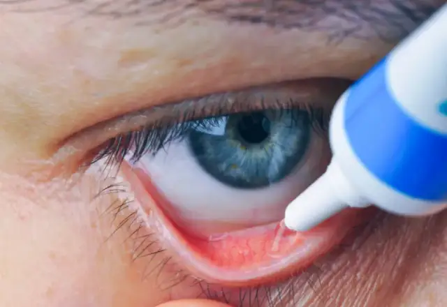 Zakraplanie oczu u okulisty po co? Zrozum skutki i korzyści.