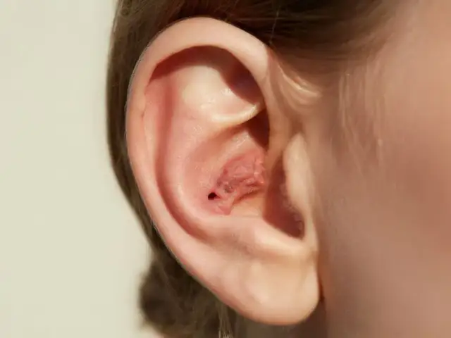 Ile goi się kolczyk w uchu? Czas, pielęgnacja i błędy