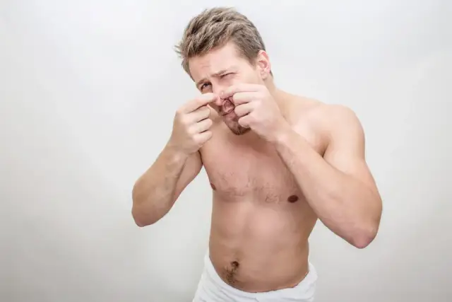 Czy pryszcze same znikają? Oto prawda, której musisz być świadomy