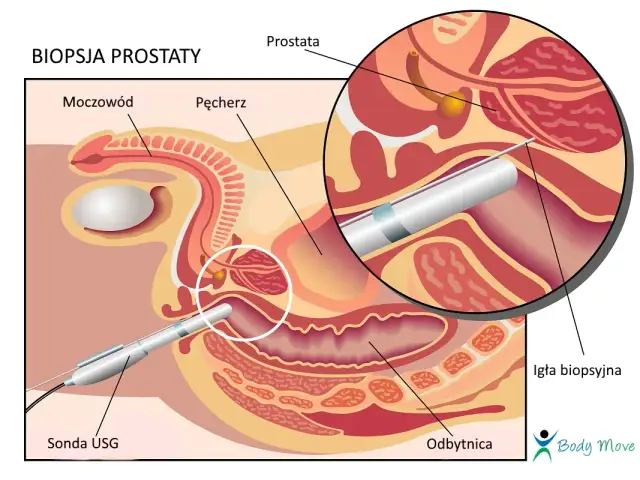 TRUS: Co to za badanie? Diagnostyka prostaty krok po kroku