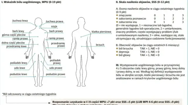 Schemat przedstawia lokalizację bólu w fibromialgii. Co to jest fibromialgia? To zespół objawów, m.in. bólu, zmęczenia, zaburzeń snu.