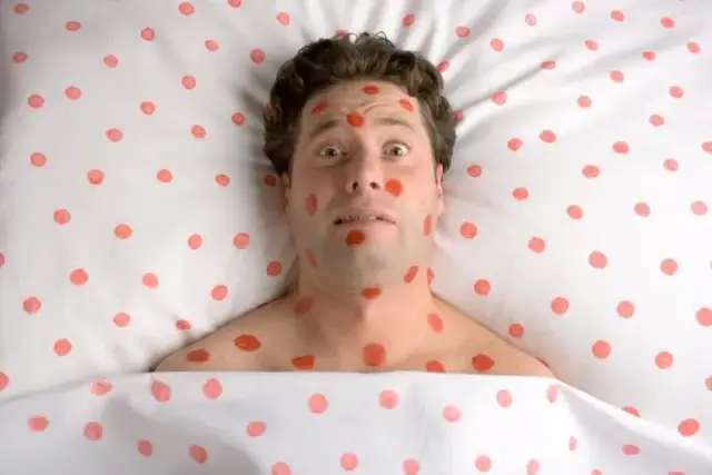 Różyczka a bezpłodność u mężczyzn: fakty i zagrożenia dla płodności