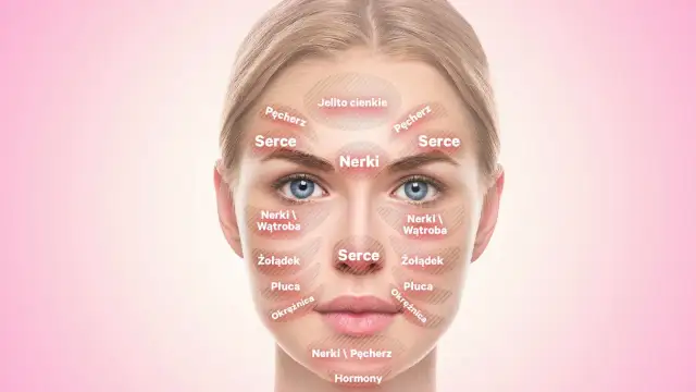 Co oznaczają pryszcze w poszczególnych miejscach i jak je leczyć