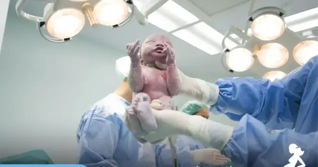 3 cesarka: kiedy jest planowana i co musisz wiedzieć