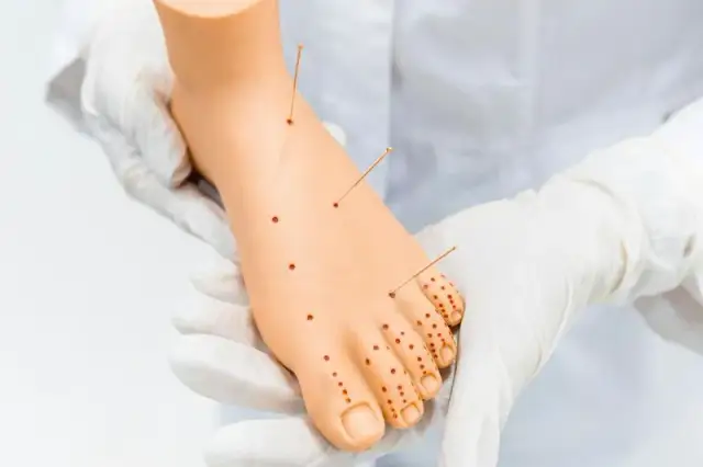 Ból kości: przyczyny, domowe sposoby i kiedy iść do lekarza