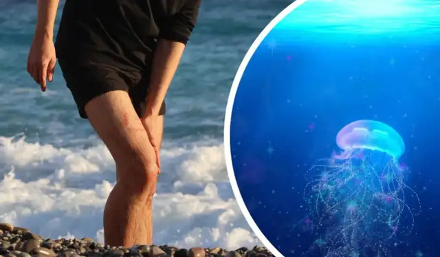 Bałtyckie meduzy: Parzą czy nie? Poznaj fakty i pierwszą pomoc