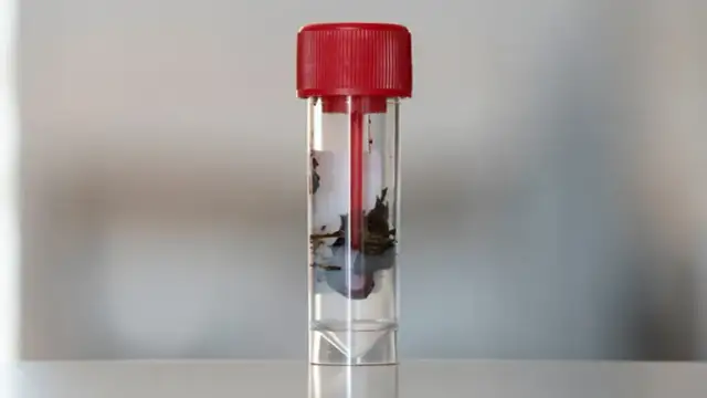 Ile kupy do badania: jak prawidłowo przygotować próbkę kału