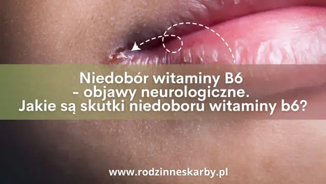 Drętwienie, lęk? Sprawdź, czy to niedobór witaminy B6!