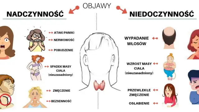 Objawy nadczynności tarczycy u osób starszych – jak je rozpoznać?