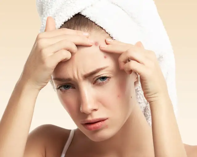 Bolesne pryszcze podskórne: Jak się ich pozbyć raz na zawsze?