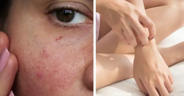 Objawy niedoboru wit D: Jak rozpoznać i uniknąć poważnych skutków