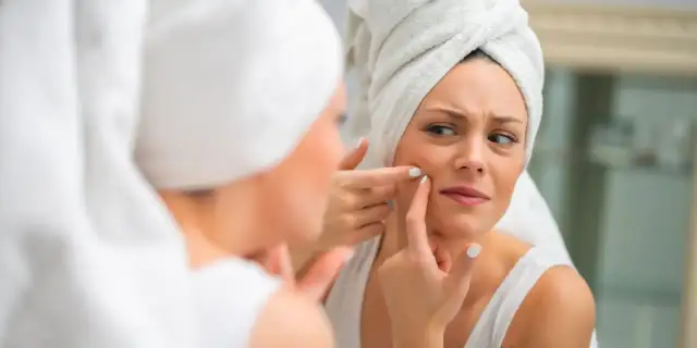 Czy pryszcze się wyciska? Poznaj ryzyko i lepsze metody pielęgnacji