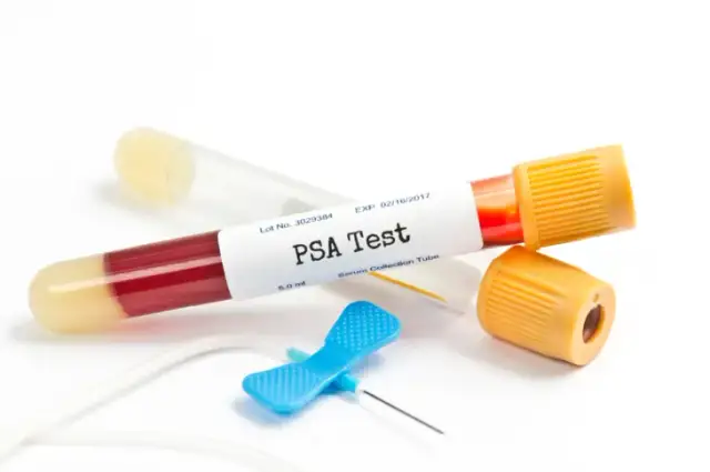 PSA co to za badanie? Kluczowe informacje o zdrowiu prostaty