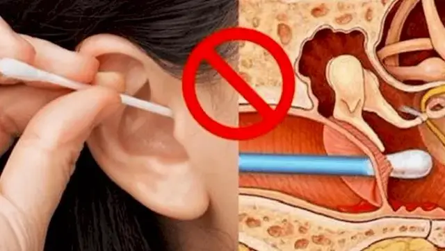 Jak czyścić uszy bezpiecznie? Obalamy mity o patyczkach!