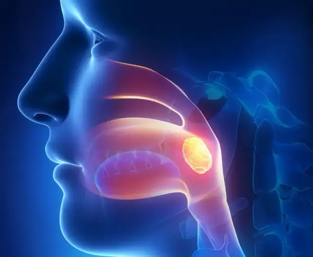 Gdzie najszybciej wyciąć migdałki NFZ? Sprawdź najlepsze opcje