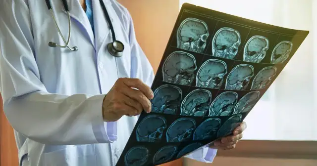 Jakie choroby psychiczne wykryje rezonans magnetyczny głowy i co to oznacza?