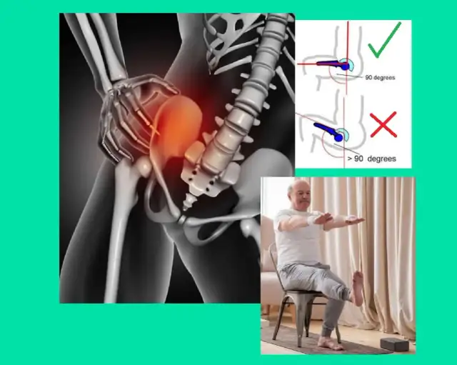 Czy po endoprotezie biodra przysługuje renta? Sprawdź, co musisz wiedzieć