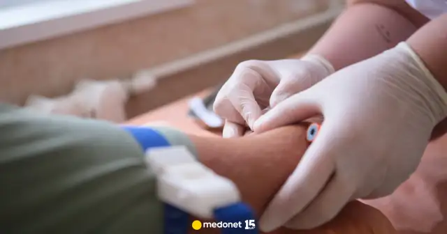 Badanie CRP: Zrozum swój wynik normy, przyczyny, interpretacja