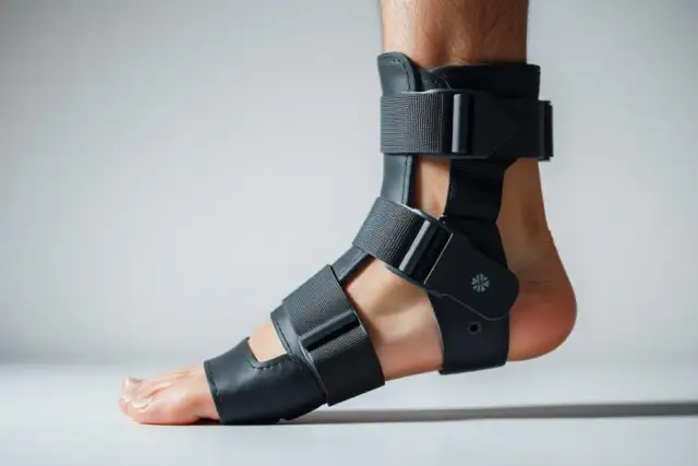 Opaski na haluksy: Kiedy pomogą, a kiedy szukać innej drogi?