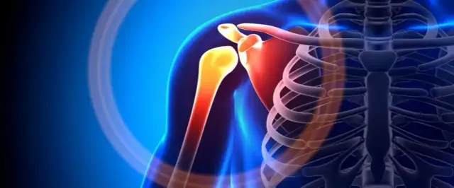 Dlaczego nie mogę podnieść ręki do góry? Odkryj przyczyny bólu