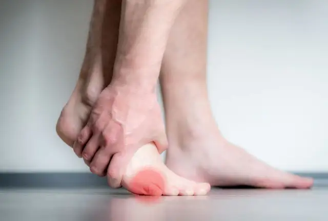 Palec krawca: Skuteczne leczenie i ulga w bólu poradnik