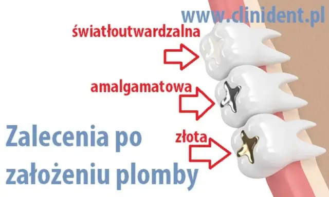 Kiedy jeść po dentyście? Sprawdź, co wolno, a czego unikać