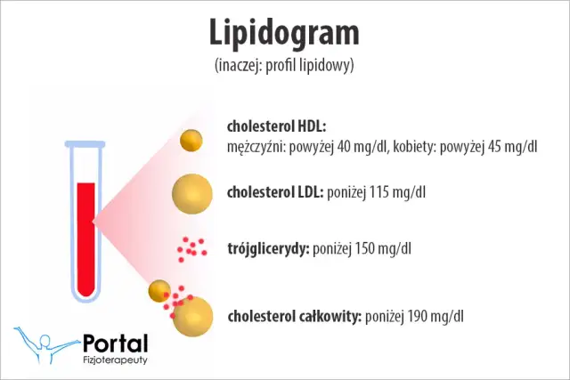 Wiarygodny lipidogram: Jak się przygotować? Uniknij błędów!