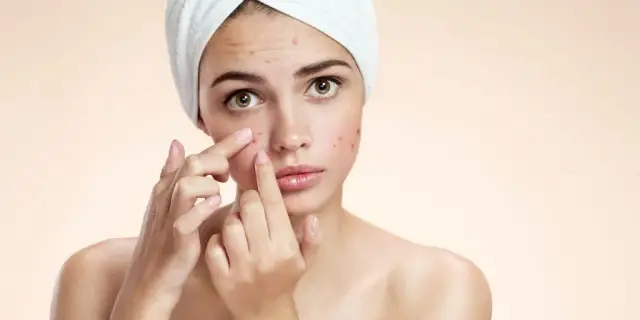 Pryszcz, który nie znika – co może oznaczać i jak leczyć?