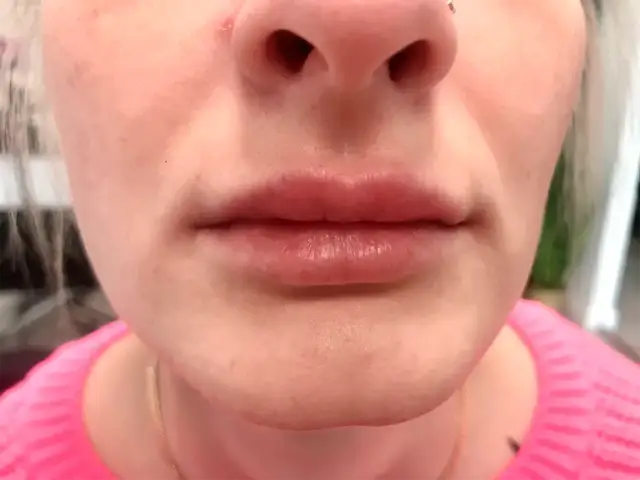 Czy makijaż permanentny ust boli? Poznaj prawdę o bólu i znieczuleniu