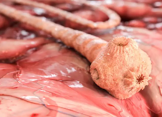 Objawy tasiemca u człowieka – jak je rozpoznać i uniknąć powikłań