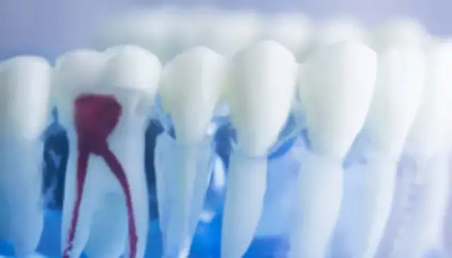 Ile kanałów ma ząb 6? Zaskakujące różnice w budowie zębów
