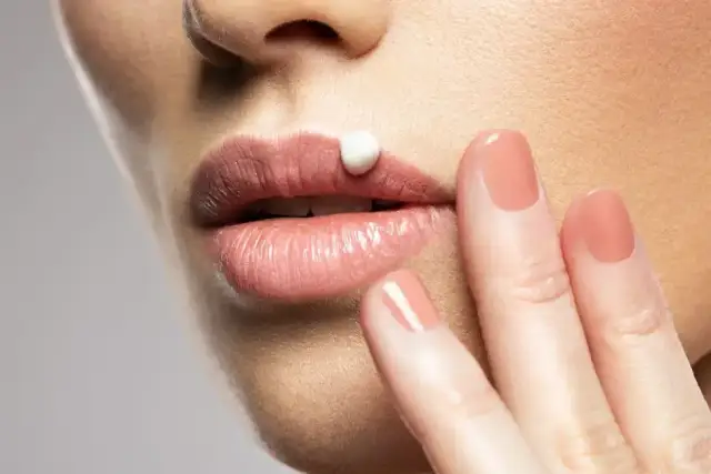 Jak skutecznie pozbyć się pryszcza na ustach i uniknąć bólu